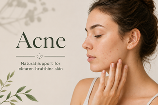 Acne Support